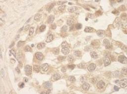 Detection of human SRPK1 by immunohistochemistry.