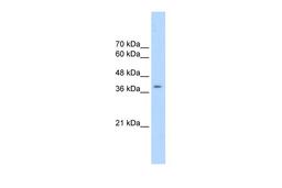 Antibody used in WB on Human 293T at 2.5 ug/ml.