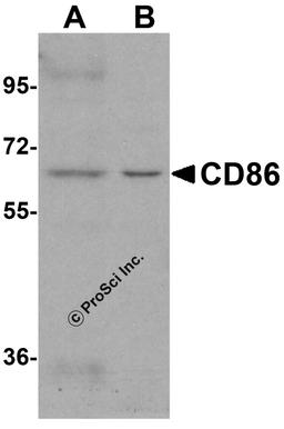 Western blot analysis of CD86 in (A) Daudi and (B) Raji cell lysate with CD86 antibody at 1 μg/mL.