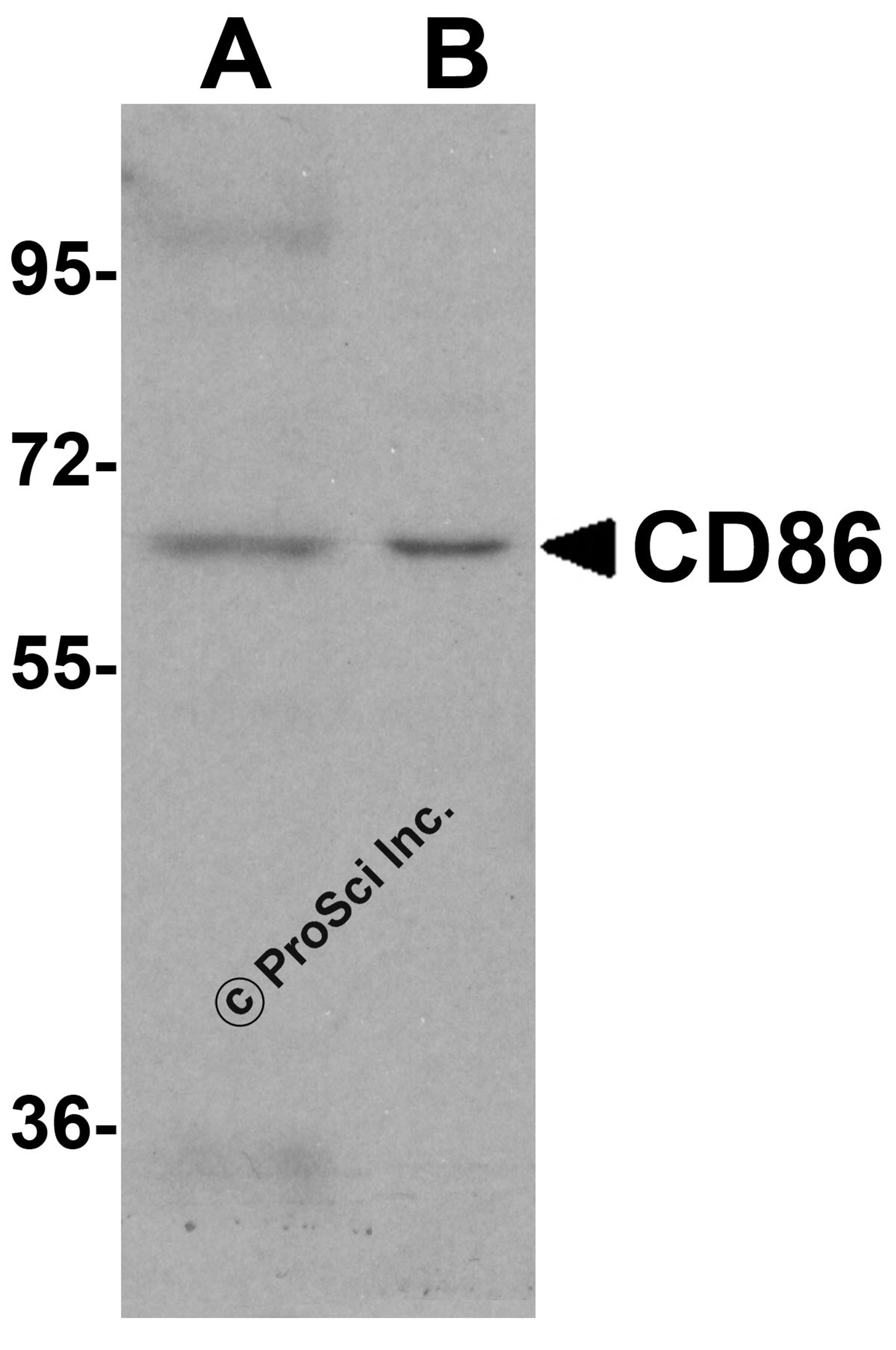 Western blot analysis of CD86 in (A) Daudi and (B) Raji cell lysate with CD86 antibody at 1 μg/mL.