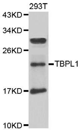 Western blot analysis of extracts of 293T cell line using TBPL1 antibody