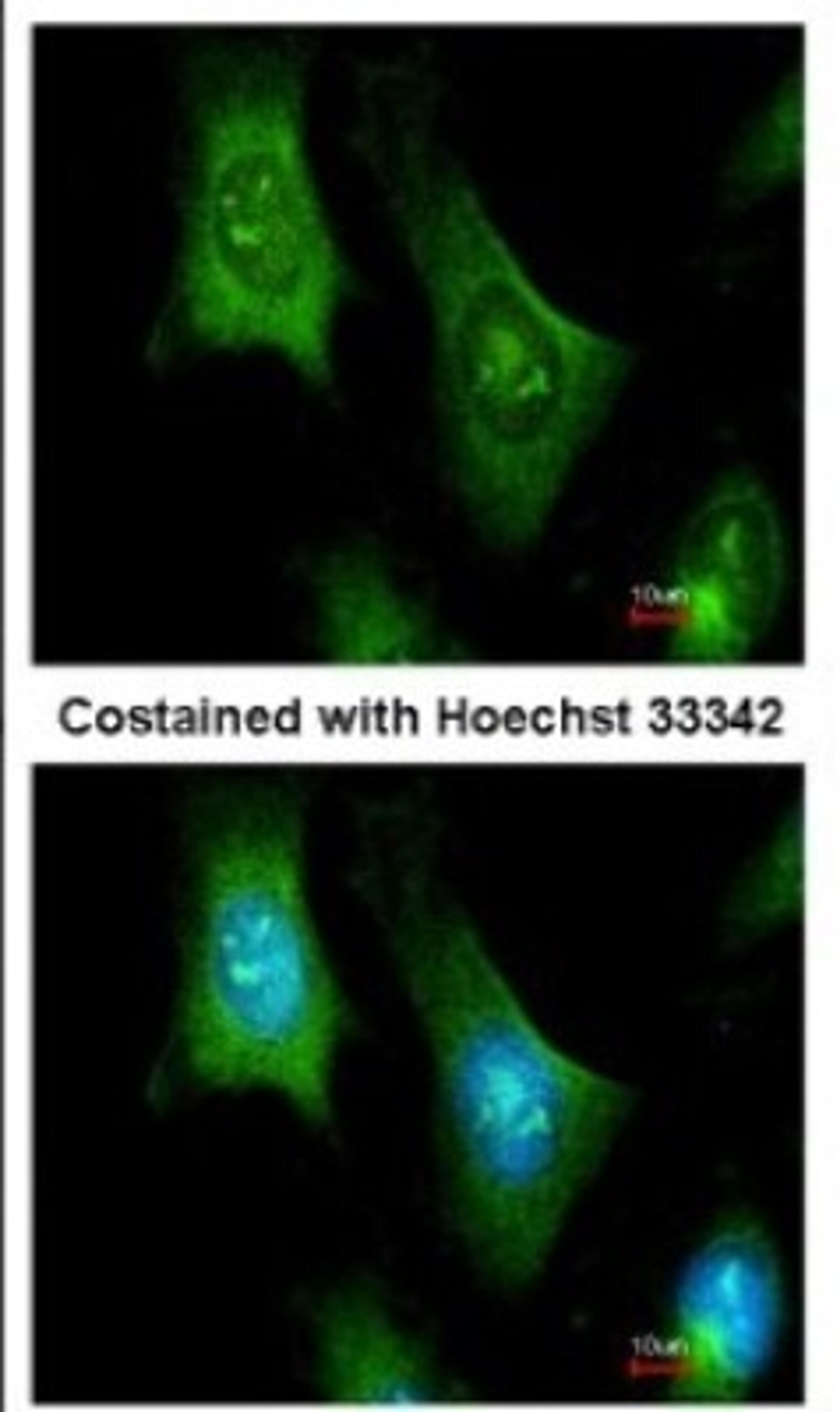 Immunocytochemistry/Immunofluorescence: PTS Antibody [NBP1-32975] - Analysis of methanol-fixed HeLa, using antibody at 1:100 dilution.