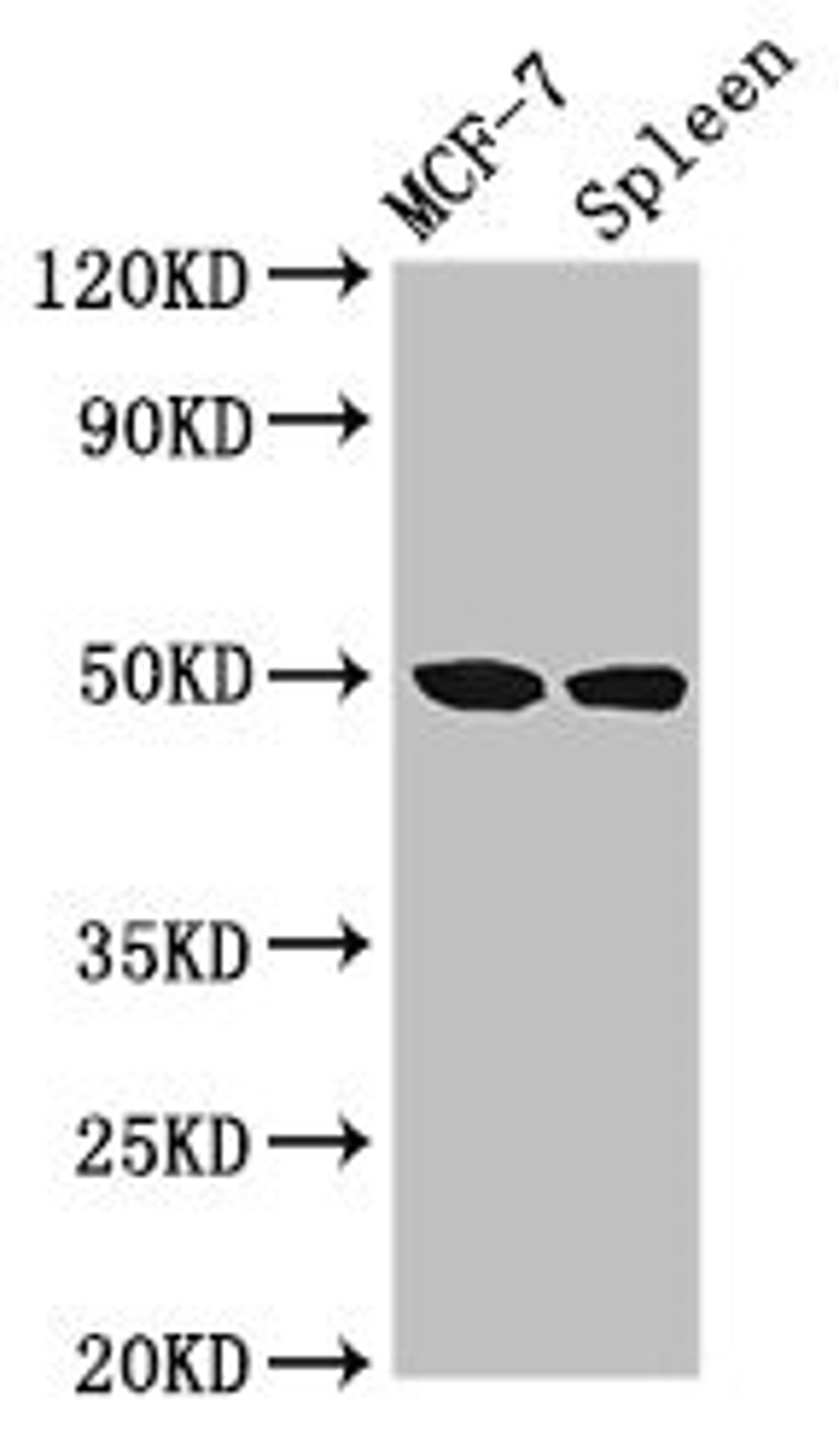 Western Blot. Positive WB detected in: MCF-7 whole cell lysate, Rat spleen tissue. All lanes: HAT1 antibody at 3µg/ml. Secondary. Goat polyclonal to rabbit IgG at 1/50000 dilution. Predicted band size: 50, 40 kDa. Observed band size: 50 kDa