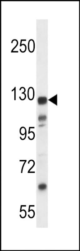 Western blot analysis in MDA-MB435 cell line lysates (35ug/lane).