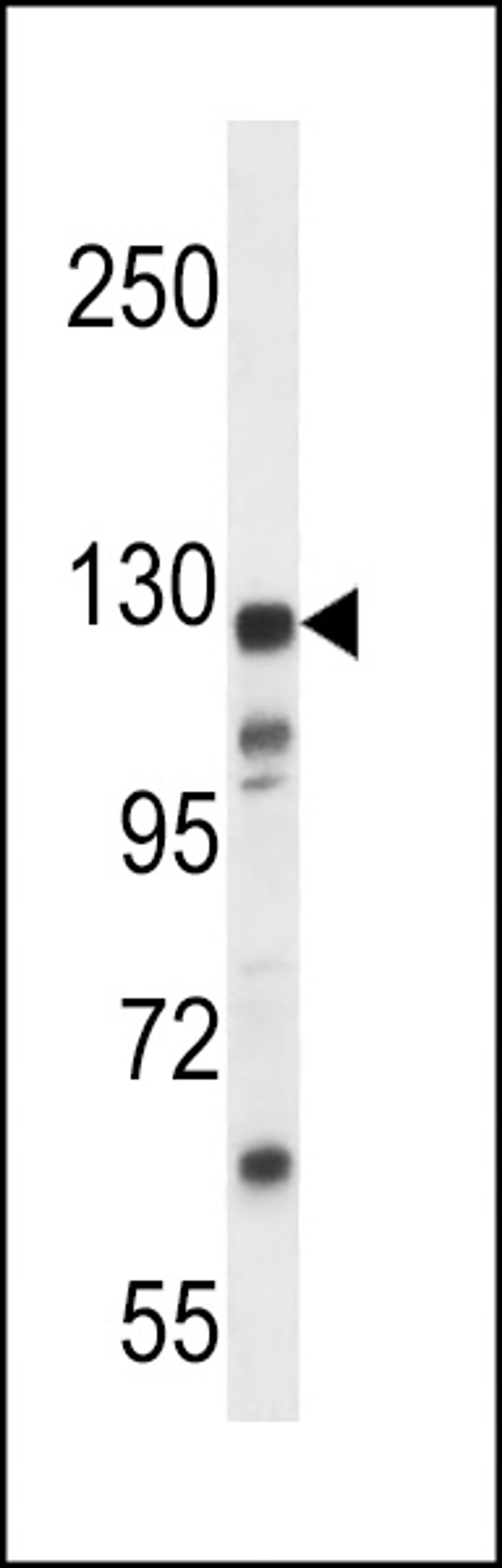 Western blot analysis in MDA-MB435 cell line lysates (35ug/lane).