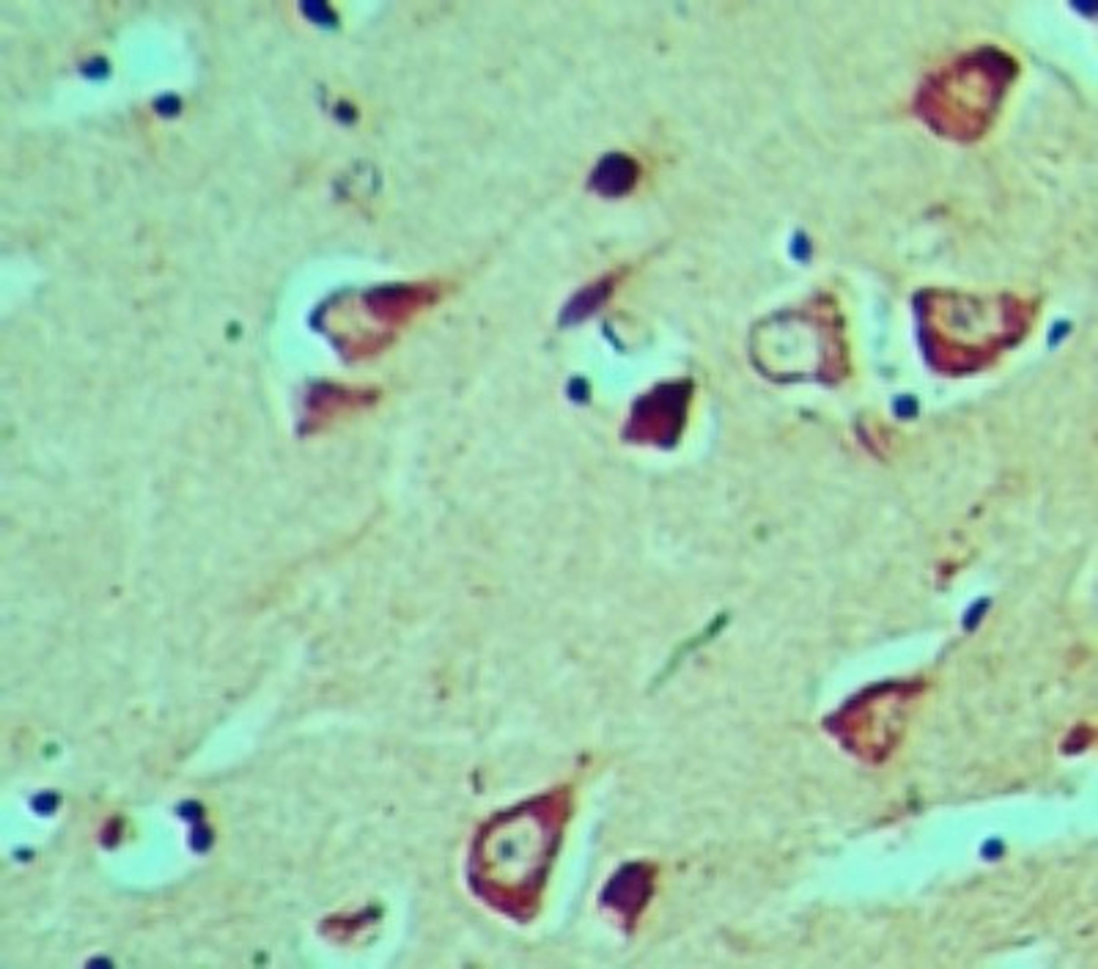 Immunohistochemistry-Paraffin: HES5 Antibody [NBP2-27174] - analysis of HES5 in formalin-fixed, paraffin-embedded human brain tissue using HES5 antibody at 5 ug/ml.