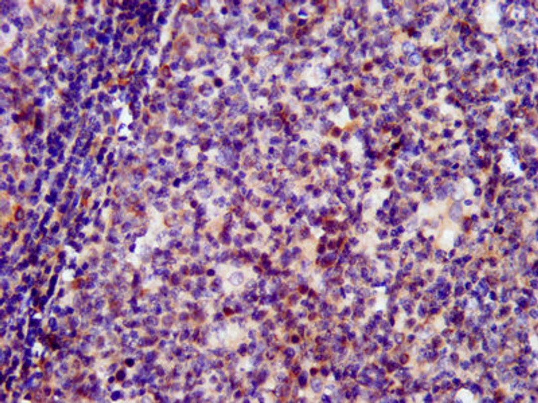 IHC image of CSB-PA021328LA01HU diluted at 1:400 and staining in paraffin-embedded human tonsil tissue performed on a Leica BondTM system.