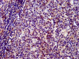 IHC image of CSB-PA021328LA01HU diluted at 1:400 and staining in paraffin-embedded human tonsil tissue performed on a Leica BondTM system.