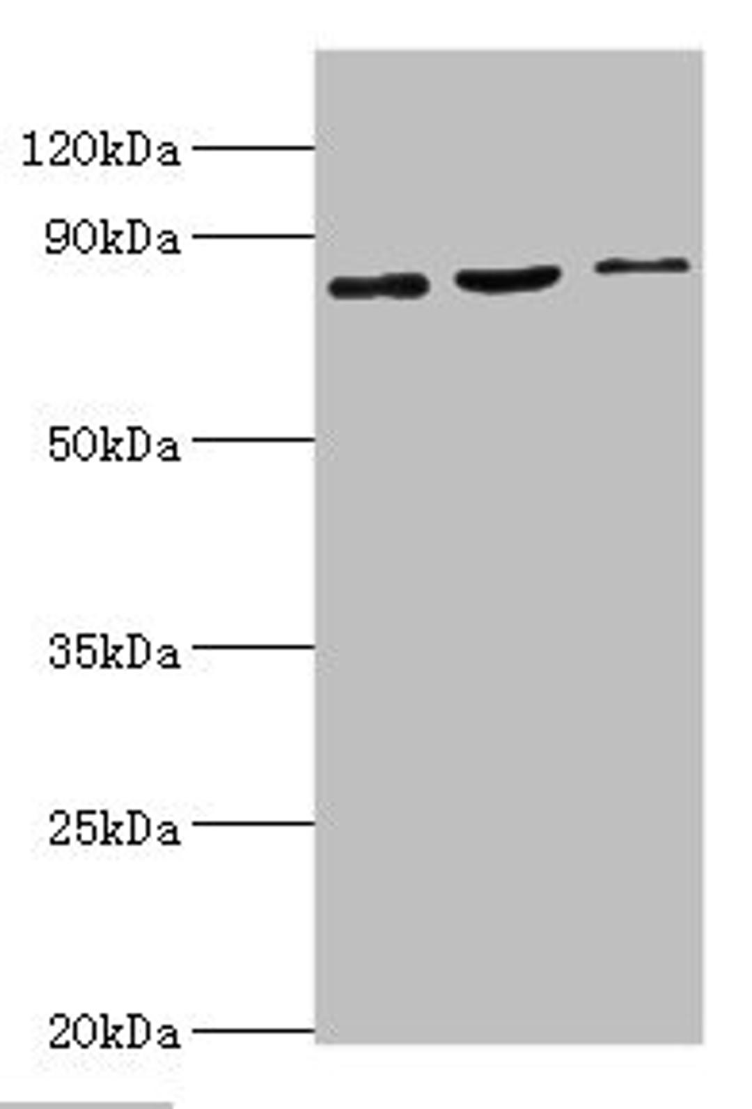 Western blot. All lanes: SATB1 antibody at 2ug/ml. Lane 1: Mouse brain tissue. Lane 2: 293T whole cell lysate. Lane 3: Jurkat whole cell lysate. Secondary. Goat polyclonal to rabbit IgG at 1/10000 dilution. Predicted band size: 86, 90 kDa. Observed band size: 86 kDa. 