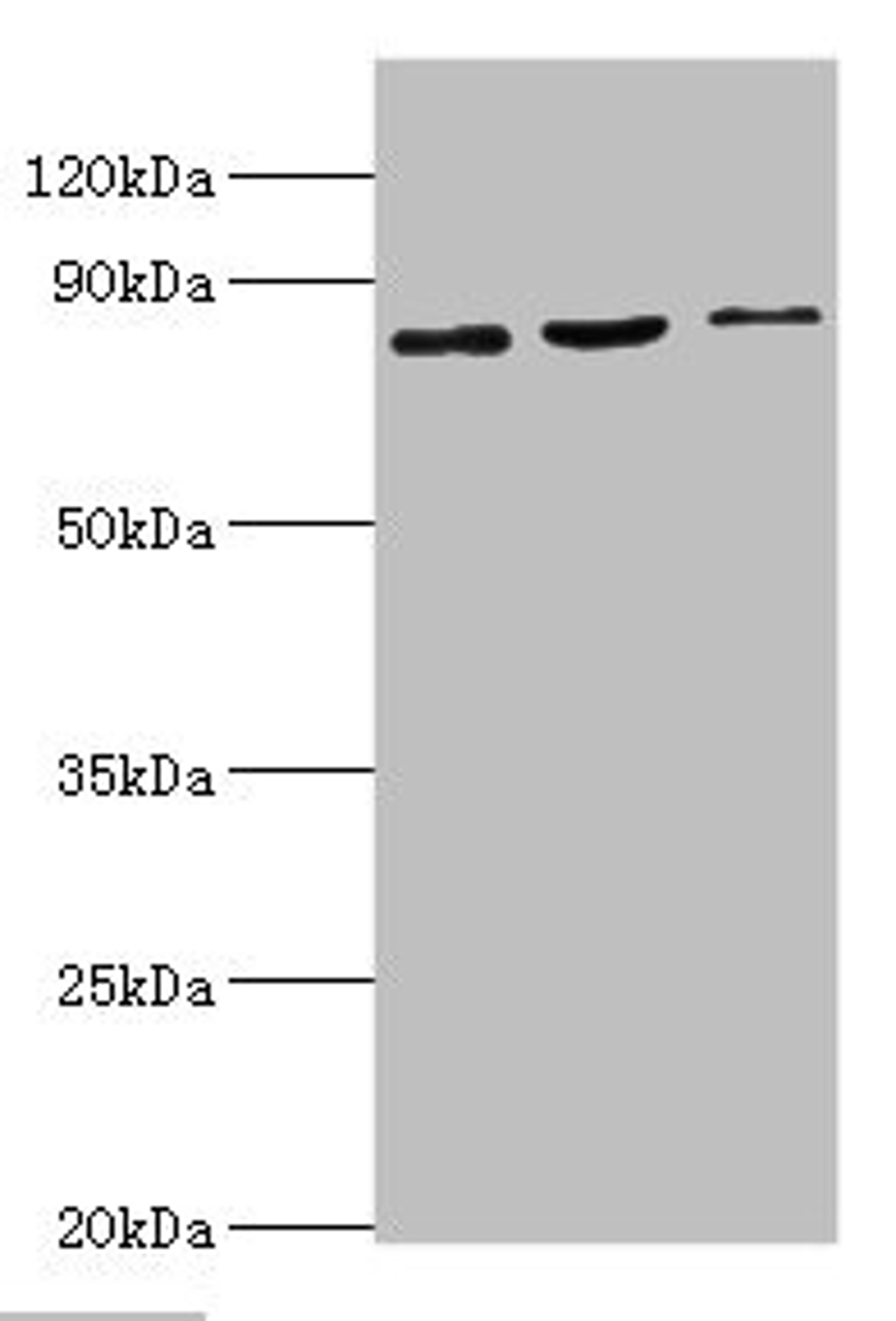 Western blot. All lanes: SATB1 antibody at 2ug/ml. Lane 1: Mouse brain tissue. Lane 2: 293T whole cell lysate. Lane 3: Jurkat whole cell lysate. Secondary. Goat polyclonal to rabbit IgG at 1/10000 dilution. Predicted band size: 86, 90 kDa. Observed band size: 86 kDa. 