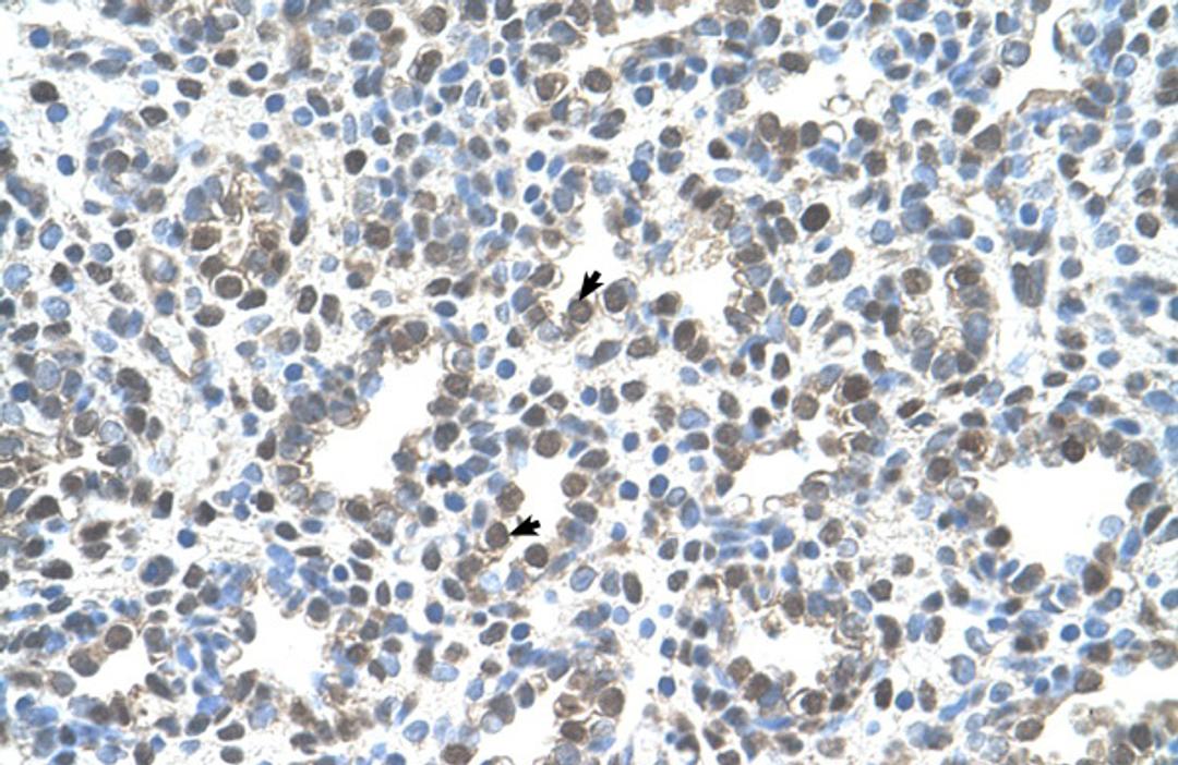 Antibody used in IHC on Human Lung.