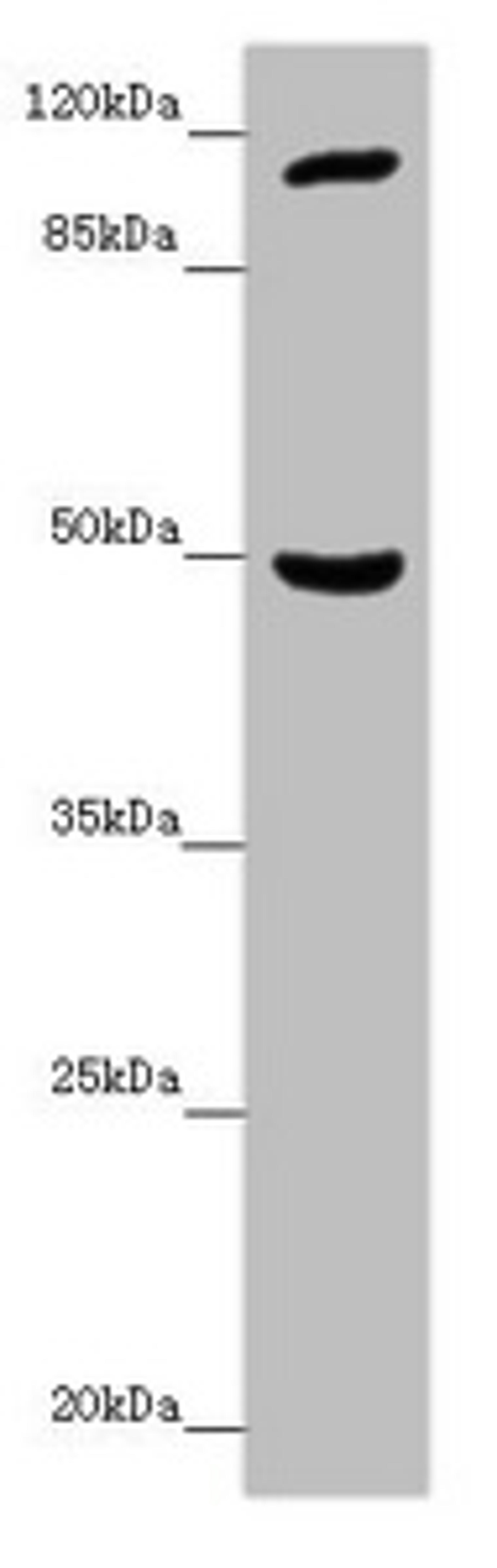 Western blot. All lanes: INPP4A antibody at 7.06 ug/ml + Mouse brain tissue. Secondary. Goat polyclonal to rabbit IgG at 1/10000 dilution. Predicted band size: 110, 106, 108 kDa. Observed band size: 110, 48 kDa.
