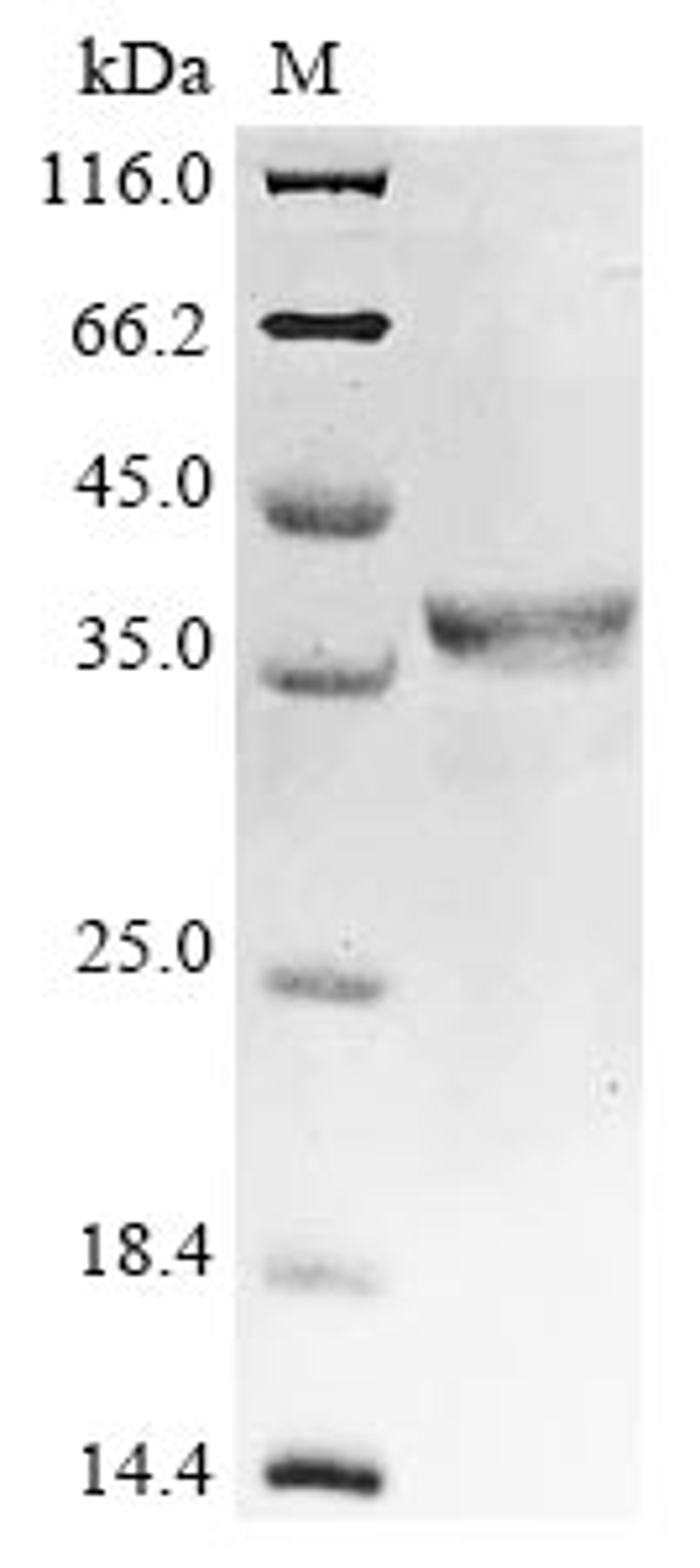 (Tris-Glycine gel) Discontinuous SDS-PAGE (reduced) with 5% enrichment gel and 15% separation gel.