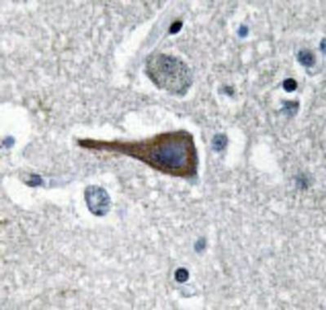 Immunohistochemistry-Paraffin: Cholecystokinin Antibody [NBP1-19789] - Human brain tissue.