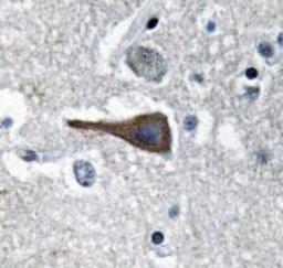 Immunohistochemistry-Paraffin: Cholecystokinin Antibody [NBP1-19789] - Human brain tissue.