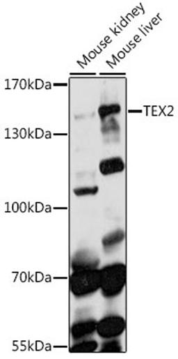 Western blot - TEX2 antibody (A14686)