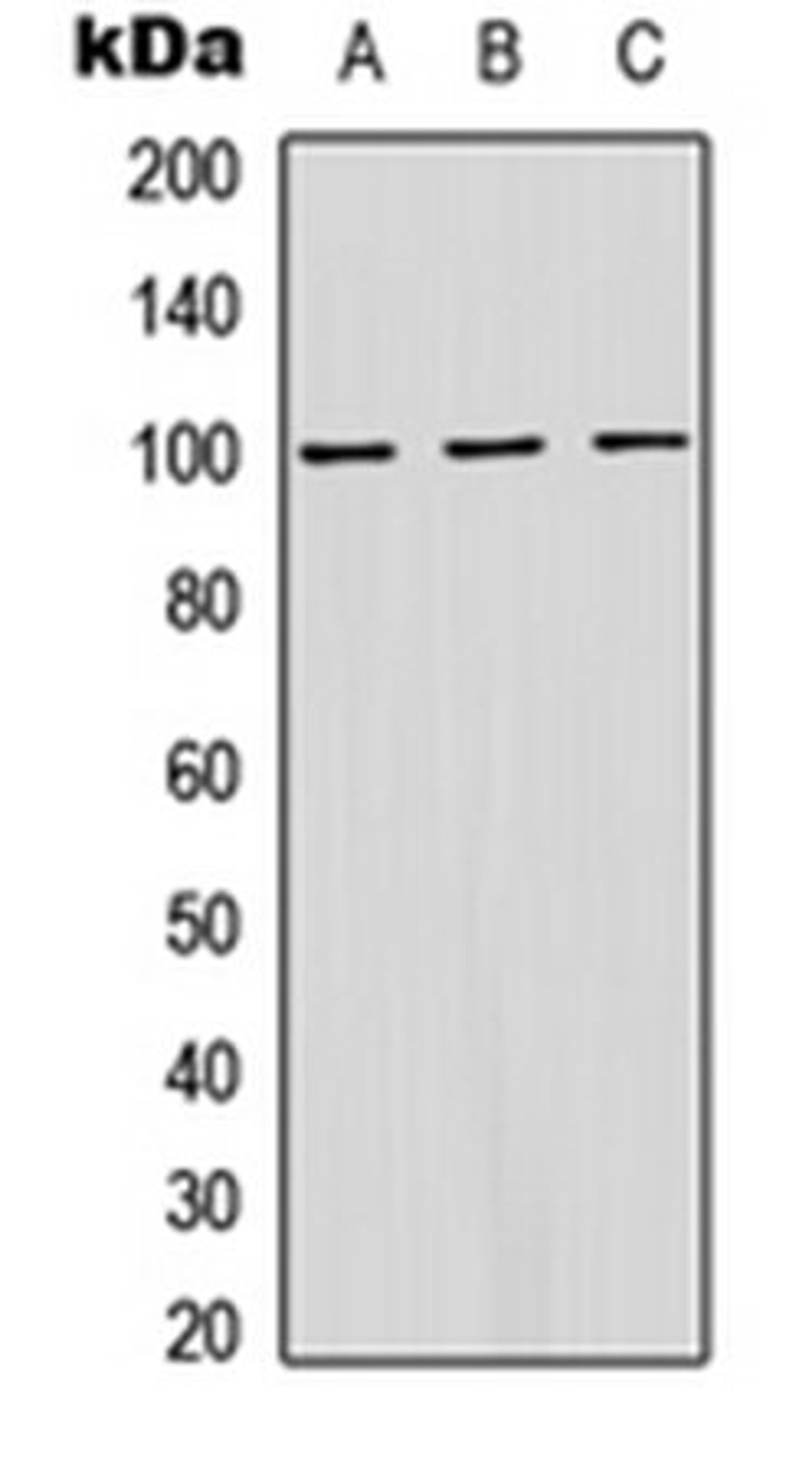 Western blot analysis of HeLa (Lane 1), MCF7 (Lane 2), Raw264.7 (Lane 3) whole cell lysates using ATP1A1 (phospho-S16) antibody