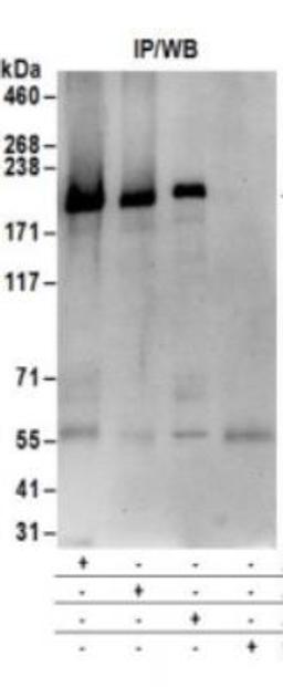 Western Blot: Blooms Syndrome Protein Blm Antibody [NB100-214] - Whole cell lysate (1 mg for IP; 20% of IP loaded) from HeLa cells.