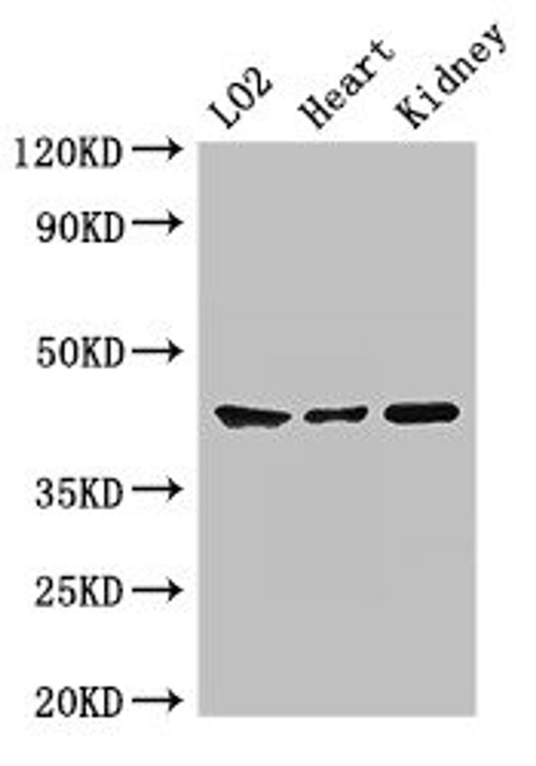Western Blot. Positive WB detected in: LO2 whole cell lysate, Mouse heart tissue, Mouse kidney tissue. All lanes: MAP2K1 antibody at 2ug/ml. Secondary. Goat polyclonal to rabbit IgG at 1/50000 dilution. Predicted band size: 44, 41 kDa. Observed band size: 44 kDa. 