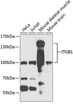 Western blot - ITGB1 antibody (A2217)