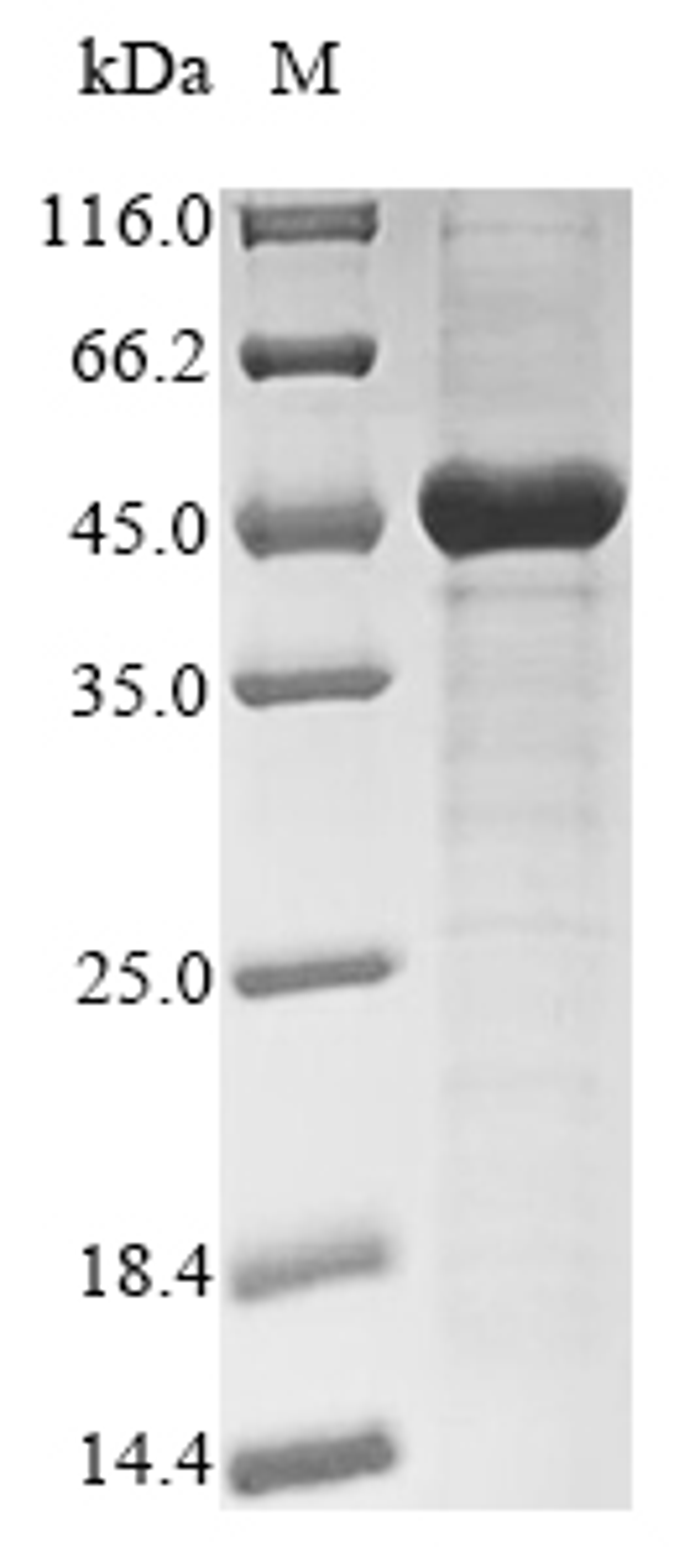 (Tris-Glycine gel) Discontinuous SDS-PAGE (reduced) with 5% enrichment gel and 15% separation gel.