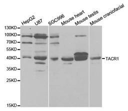 Western blot analysis of extracts of various cell lines using TACR1 antibody