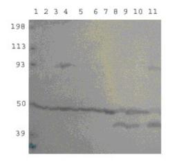 Western Blot: PDE10A Antibody [NB300-645] - NB300-645 (1:500) using CNS Blot. 1. Frontal Cortex 2. Pariental Cortex 3. Striatum 4. Amygdela 5. Hypothalamus 6. Hippocampus 7. Olfactory bulb 8. Brain Stem 9. Cerebellum 10. Spinal cord and 11. Whole Brain.