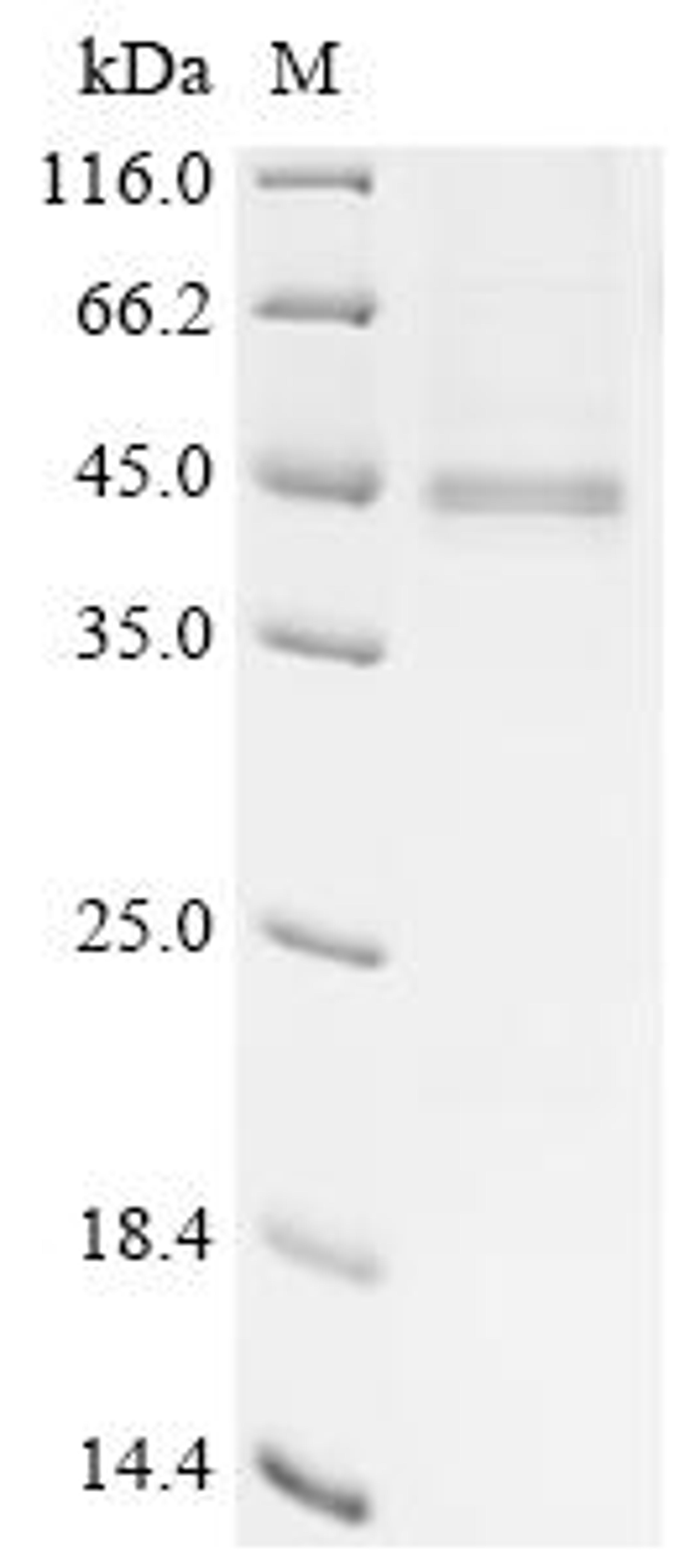 (Tris-Glycine gel) Discontinuous SDS-PAGE (reduced) with 5% enrichment gel and 15% separation gel.