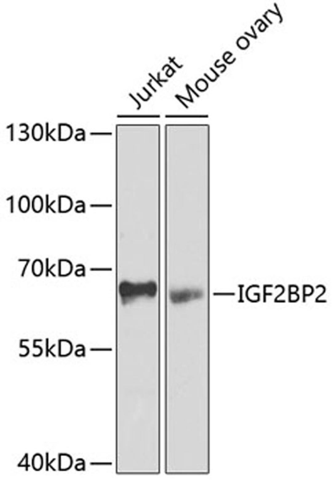 Western blot - IGF2BP2 antibody (A2749)