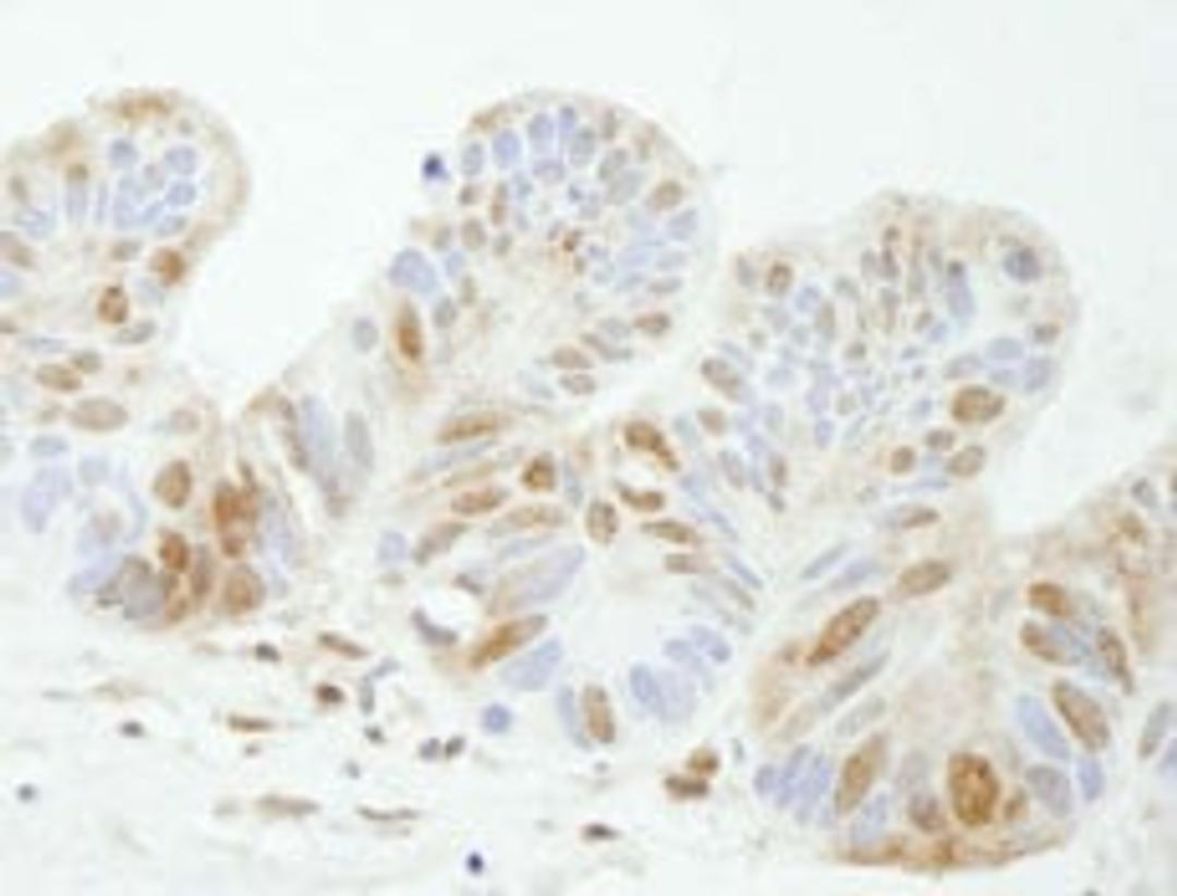 Detection of human TDP1 by immunohistochemistry.