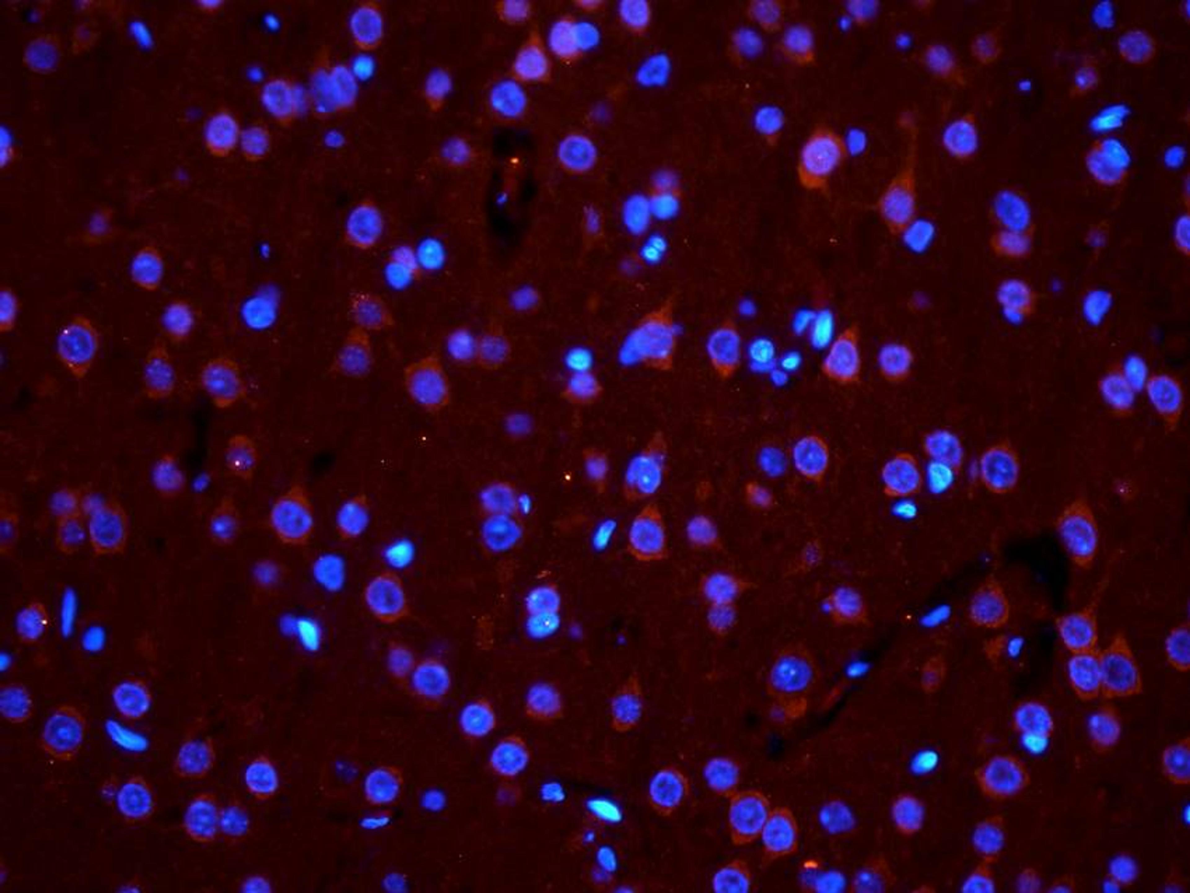 IF analysis of rat brain tissue using PGP 9.5 antibody (dilution of primary antibody at 2.5 ug/ml)