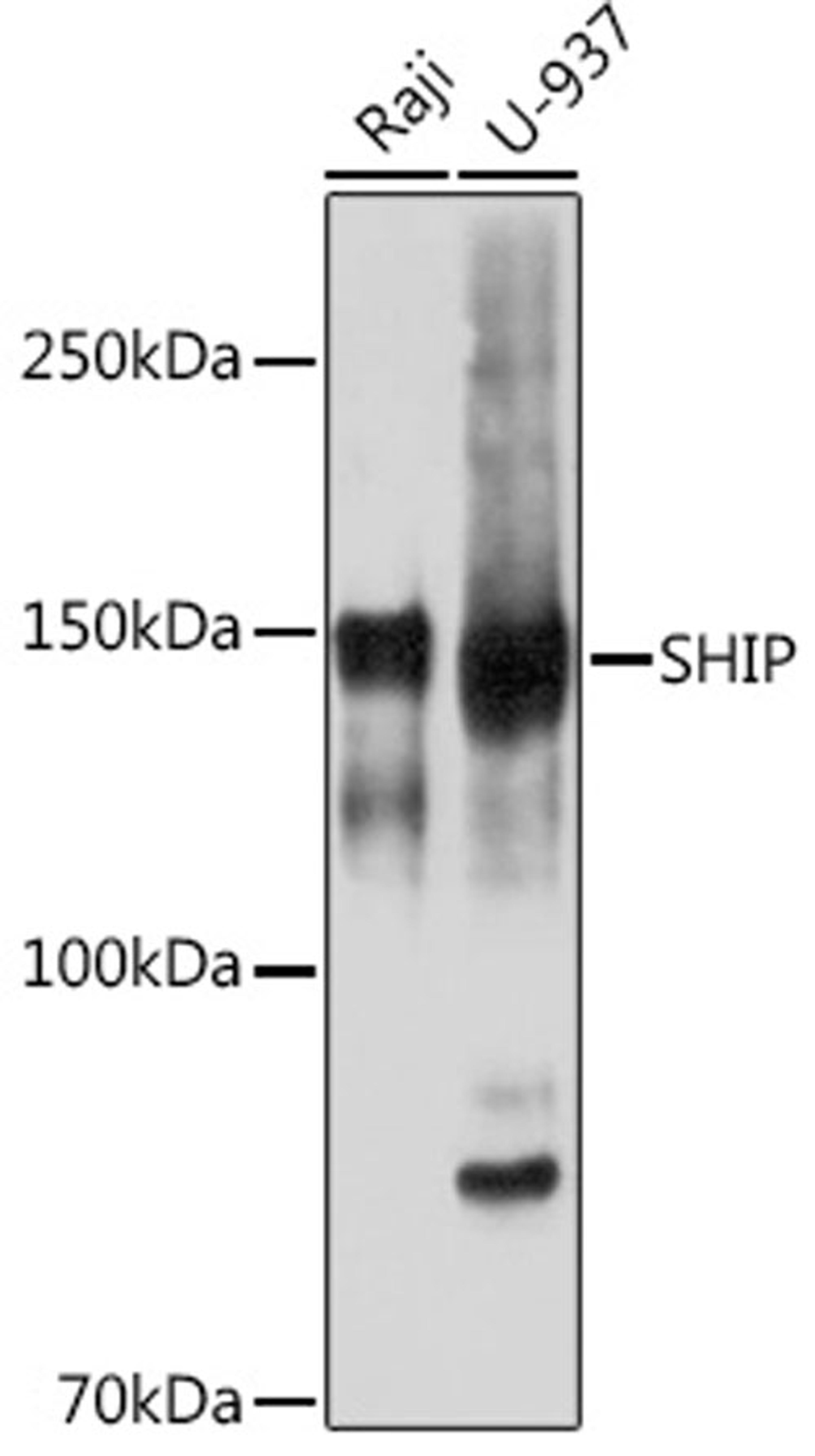 Western blot - SHIP Rabbit mAb (A3571)
