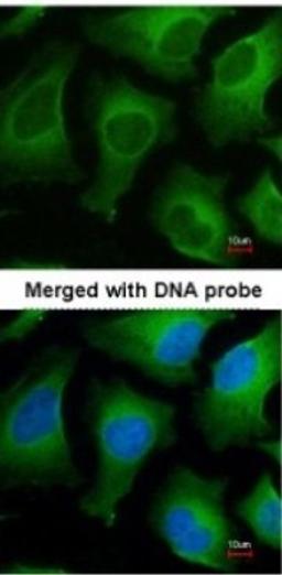 Immunocytochemistry/Immunofluorescence: APRT Antibody [NBP1-31332] - Paraformaldehyde-fixed HeLa, using antibody at 1:200 dilution.