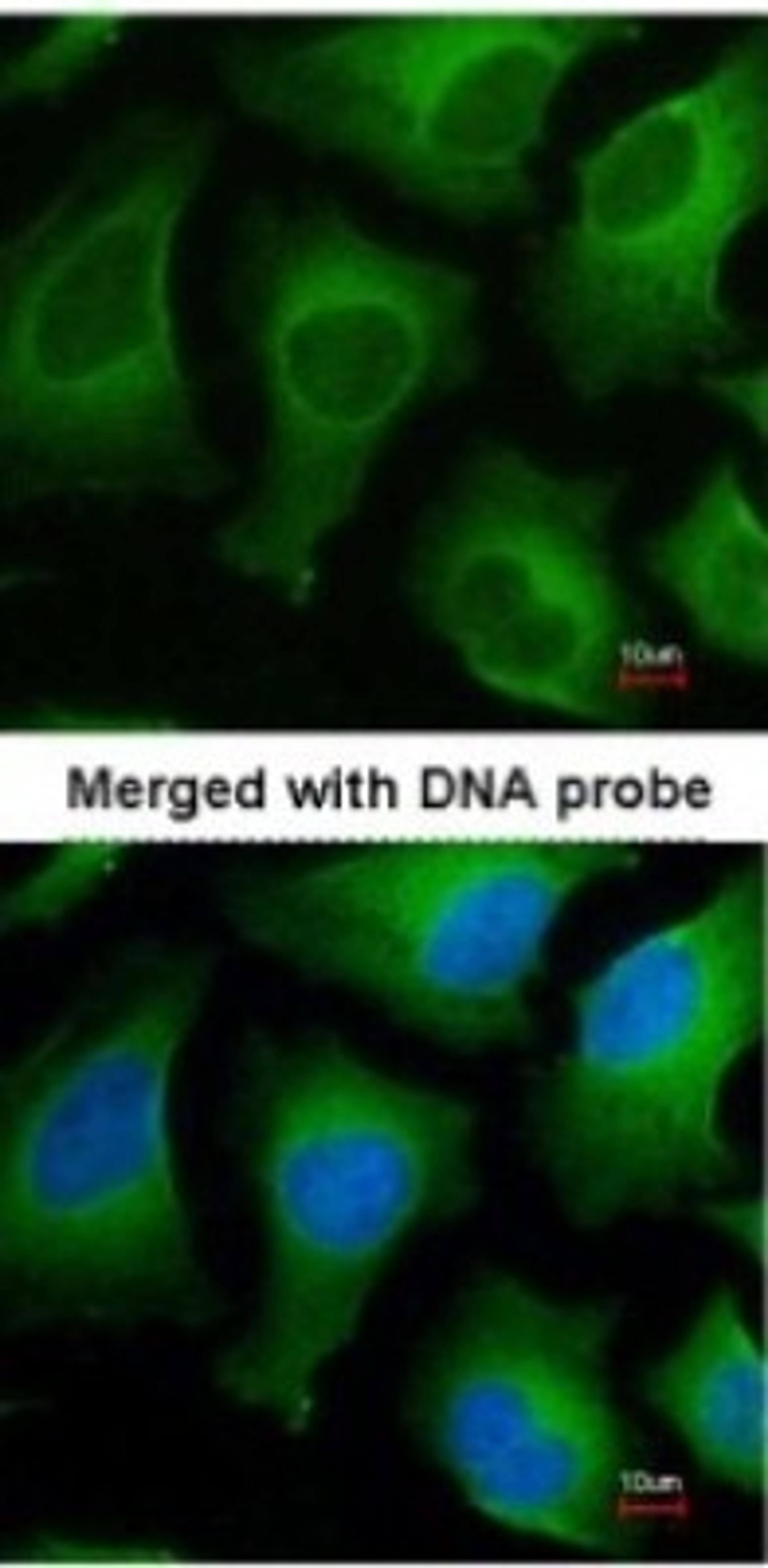 Immunocytochemistry/Immunofluorescence: APRT Antibody [NBP1-31332] - Paraformaldehyde-fixed HeLa, using antibody at 1:200 dilution.