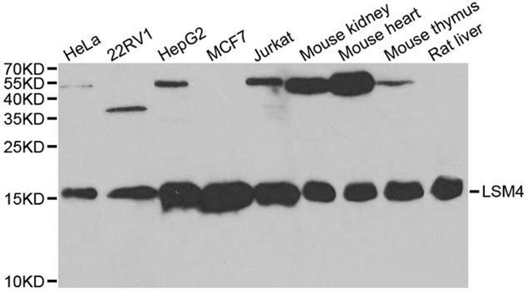 Western blot analysis of extracts of various cell lines using LSM4 antibody