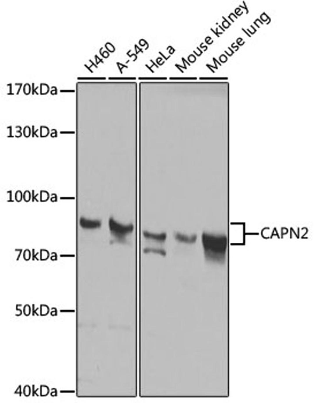 Western blot - CAPN2 antibody (A1861)