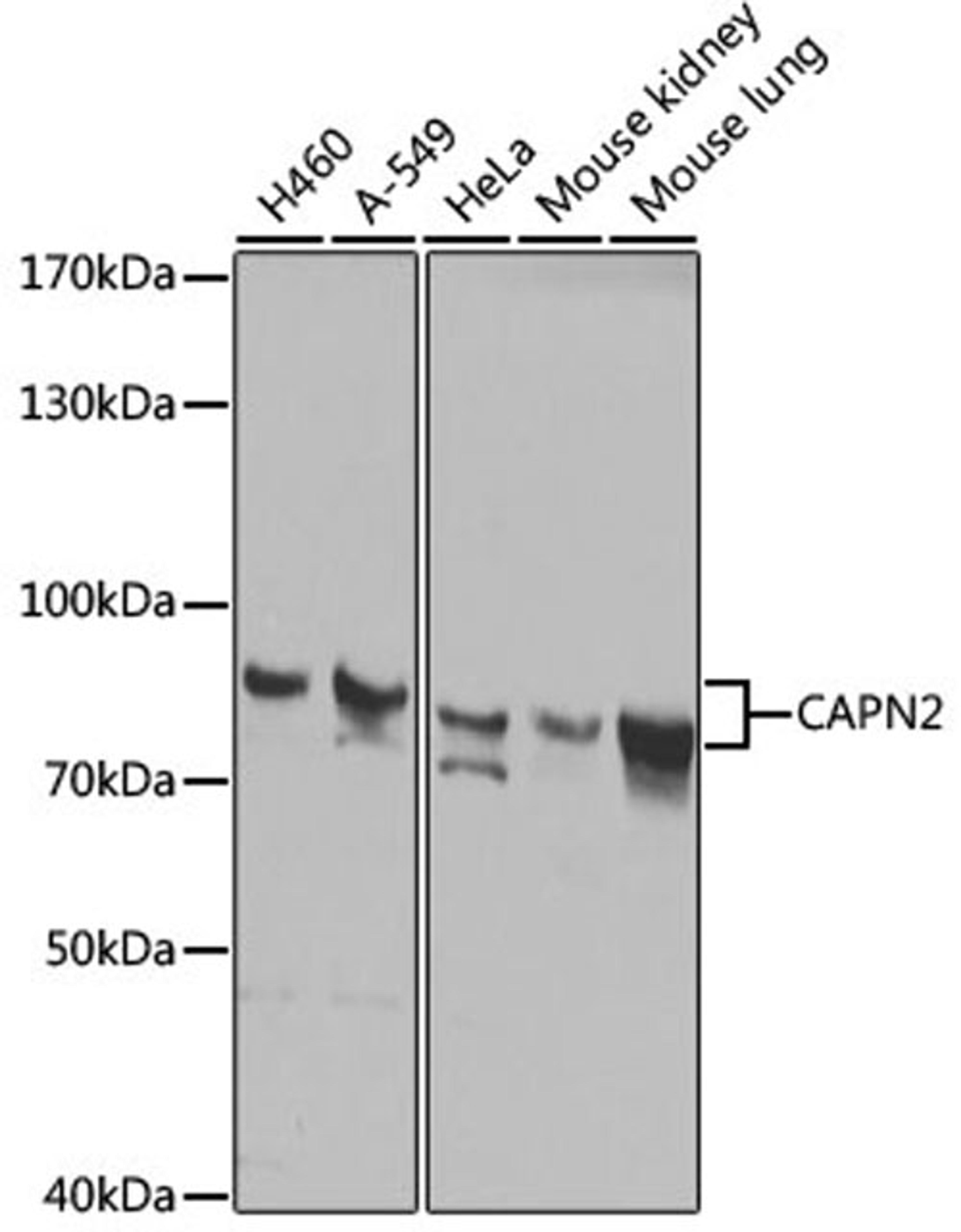 Western blot - CAPN2 antibody (A1861)