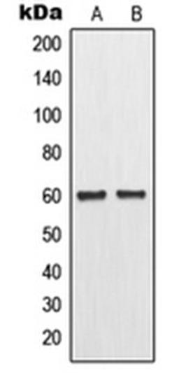 Western blot analysis of MCF7 (Lane 1), Raw264.7 (Lane 2) whole cell lysates using MMP11 antibody