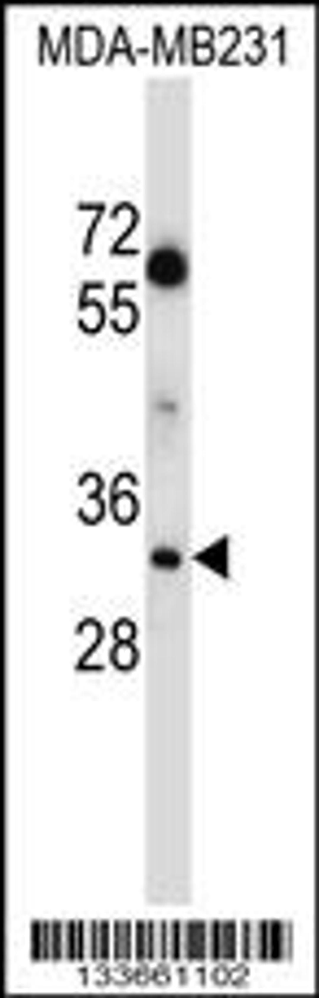 Western blot analysis in MDA-MB231 cell line lysates (35ug/lane).