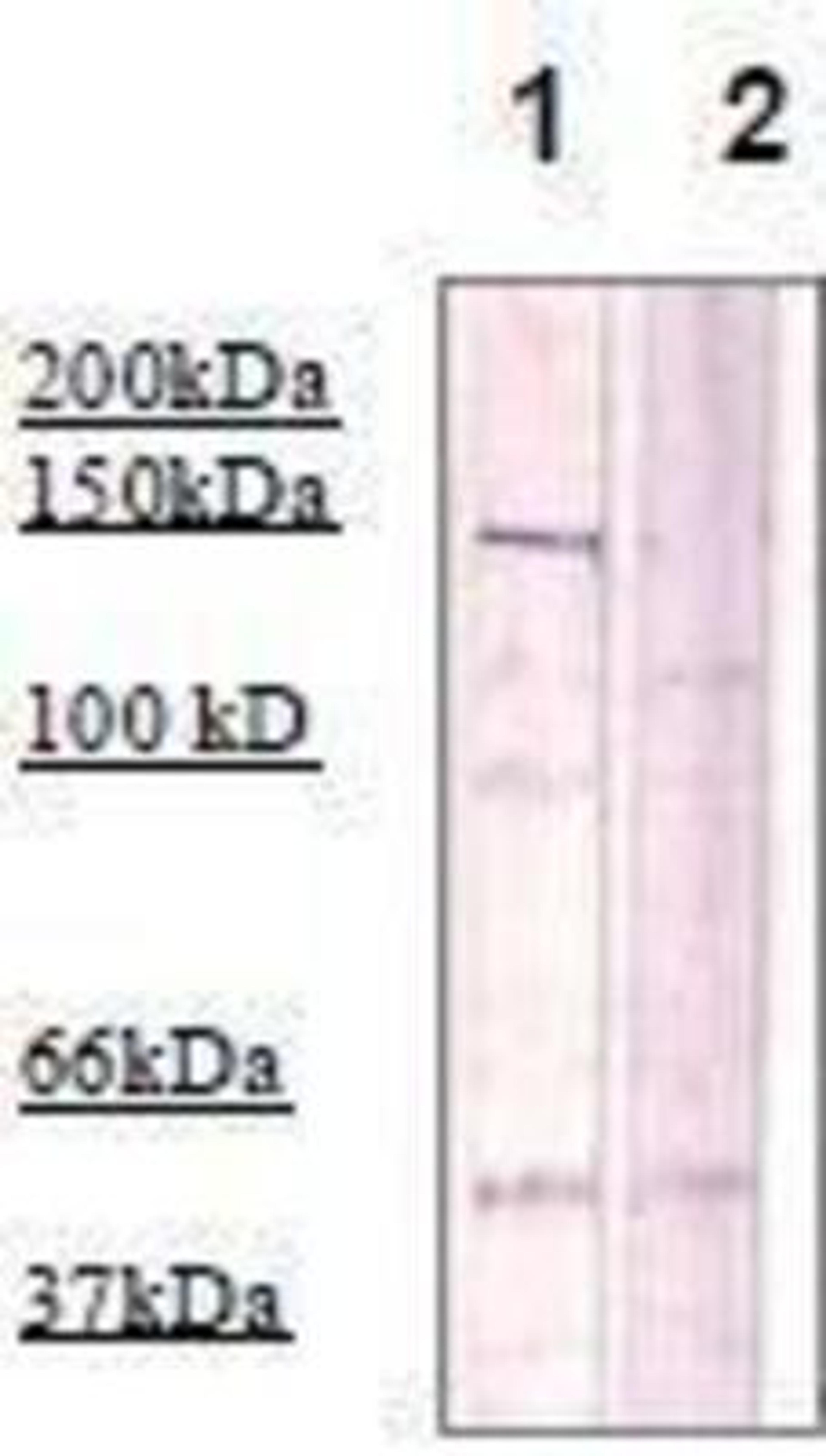 Western Blot: ROCK2 Antibody [NBP1-72216] - The cell lysate derived from Conditioned 3T3 cell was immunoprecipitated by Rabbit anti Rho Kinase (pT396), then immunoprobed by the same antibody at 1:500 (lane 1). Lane 2 is a negative control.