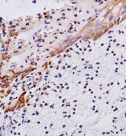 Immunohistochemical analysis of formalin fixed and paraffin embedded rat skin tissue using IL29 antibody