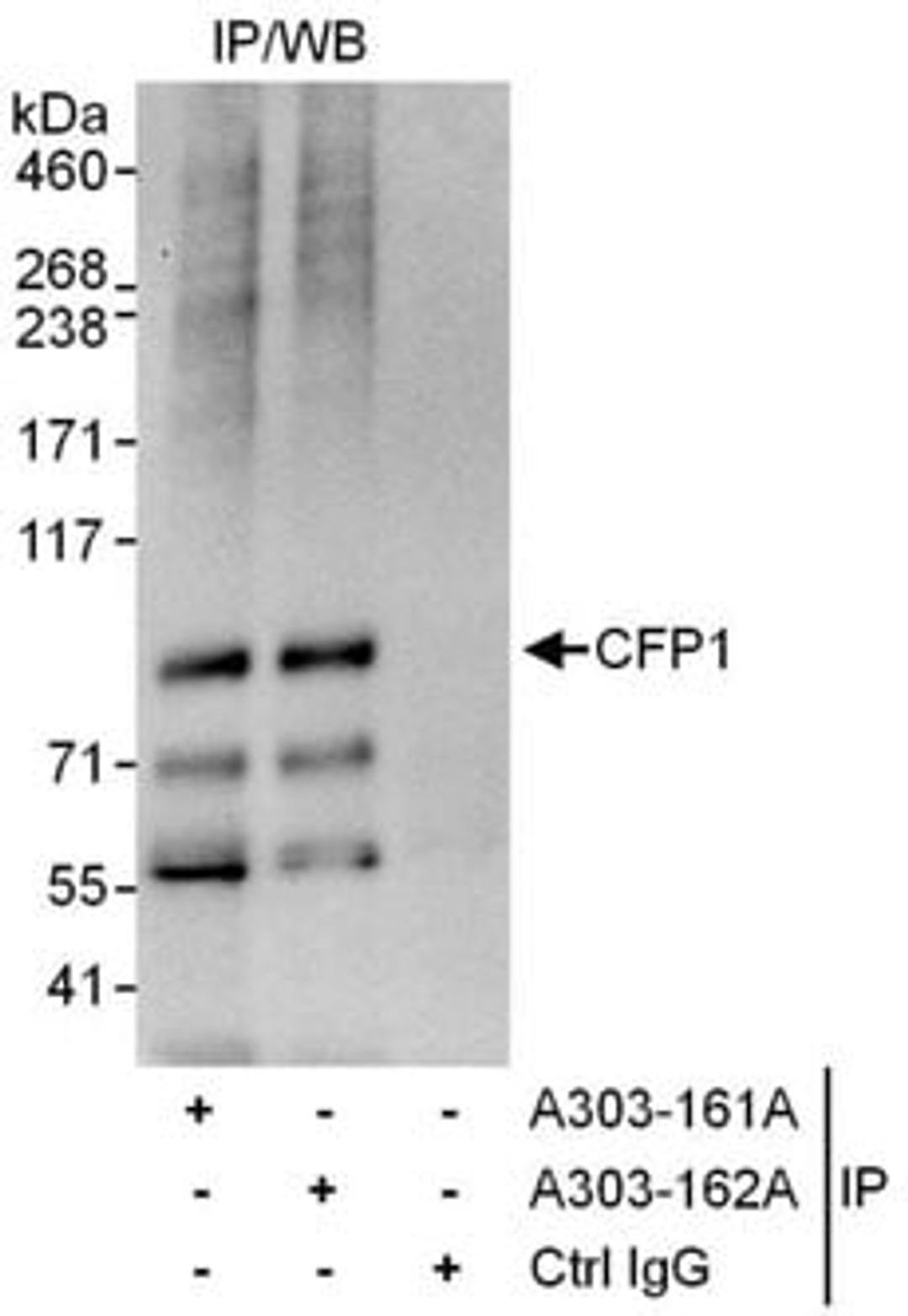 Detection of human CFP1 by western blot of immunoprecipitates.