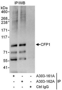 Detection of human CFP1 by western blot of immunoprecipitates.