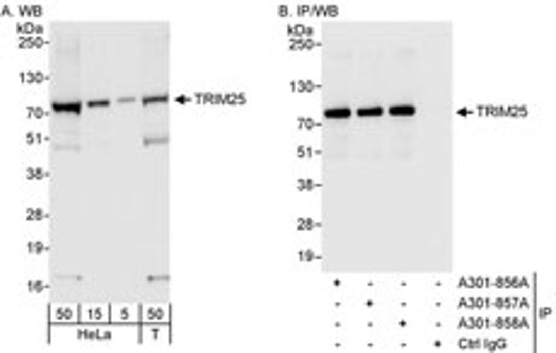 Detection of human TRIM25 by western blot and immunoprecipitation.