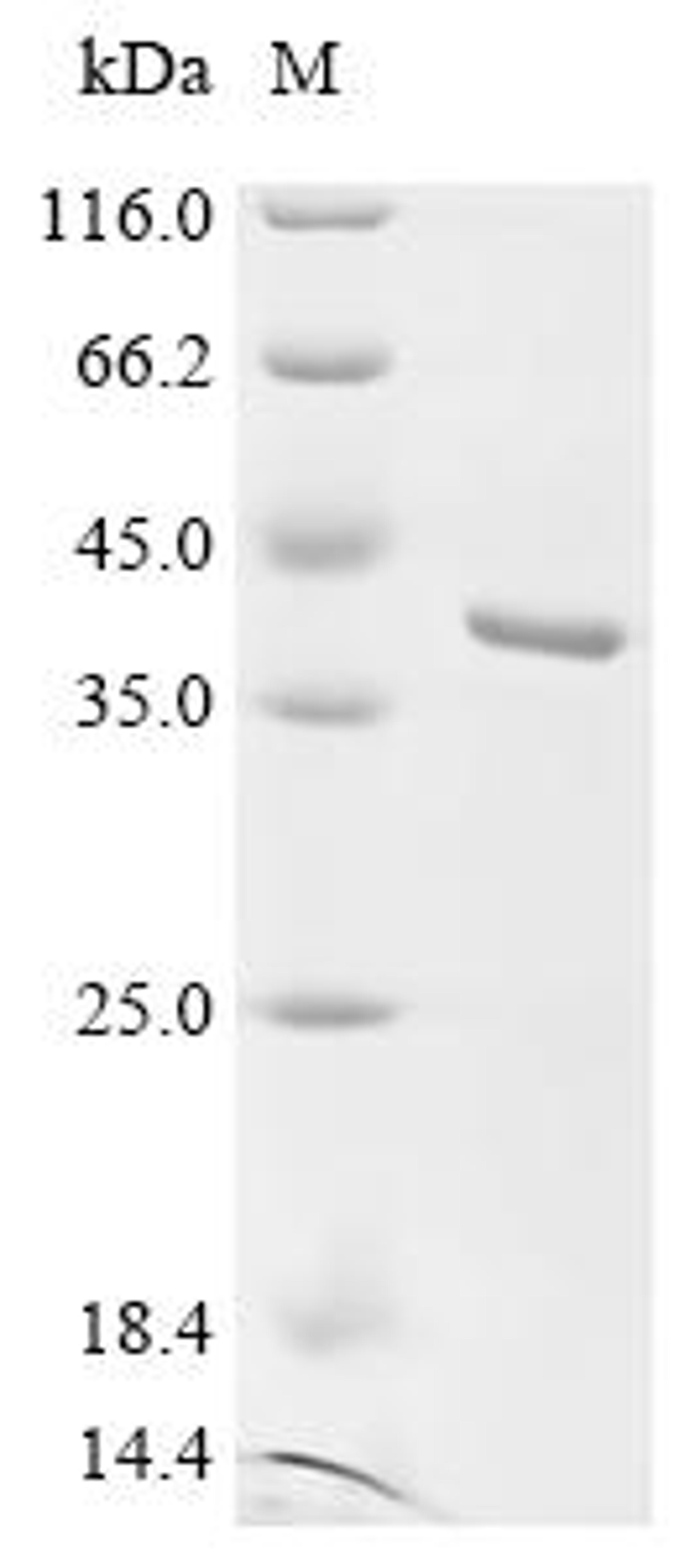 (Tris-Glycine gel) Discontinuous SDS-PAGE (reduced) with 5% enrichment gel and 15% separation gel.