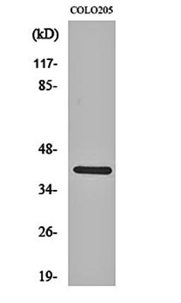 Western blot analysis of COLO205 cell lysates using KKIALRE antibody