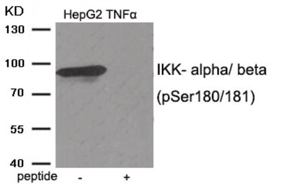 Western blot analysis of extracts from HepG2 cells treated with TNF using IKK- alpha/ beta (Phospho-Ser180/181) Antibody. The lane on the right is treated with the antigen-specific peptide.