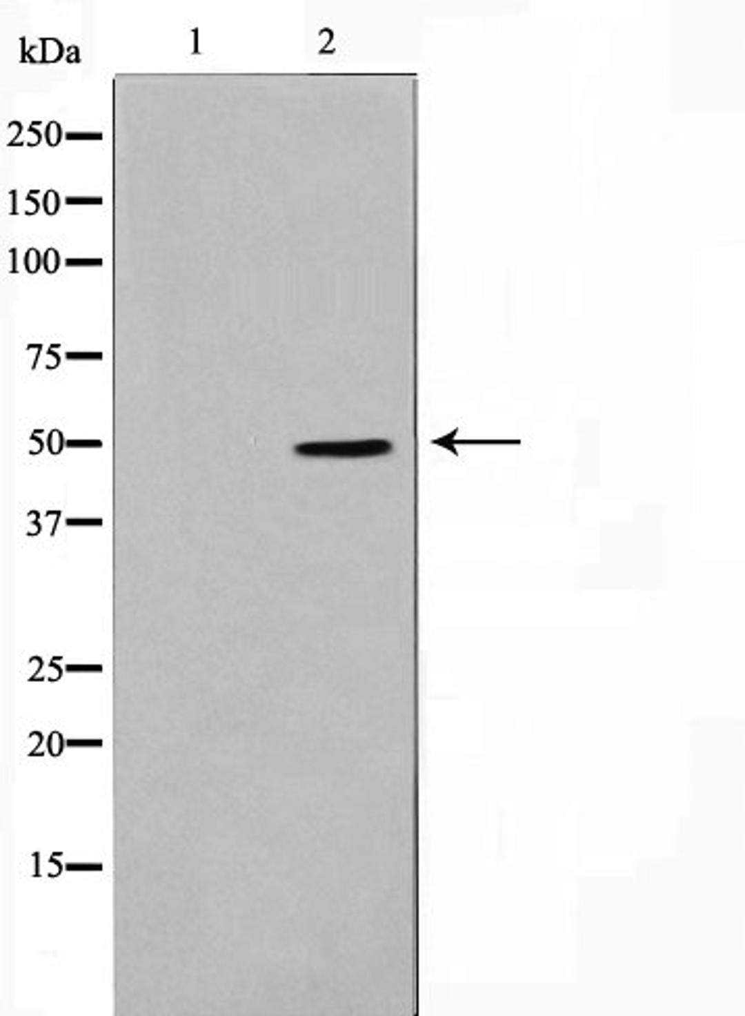 Western blot analysis of LOVO cell lysate using TNF-R2 antibody