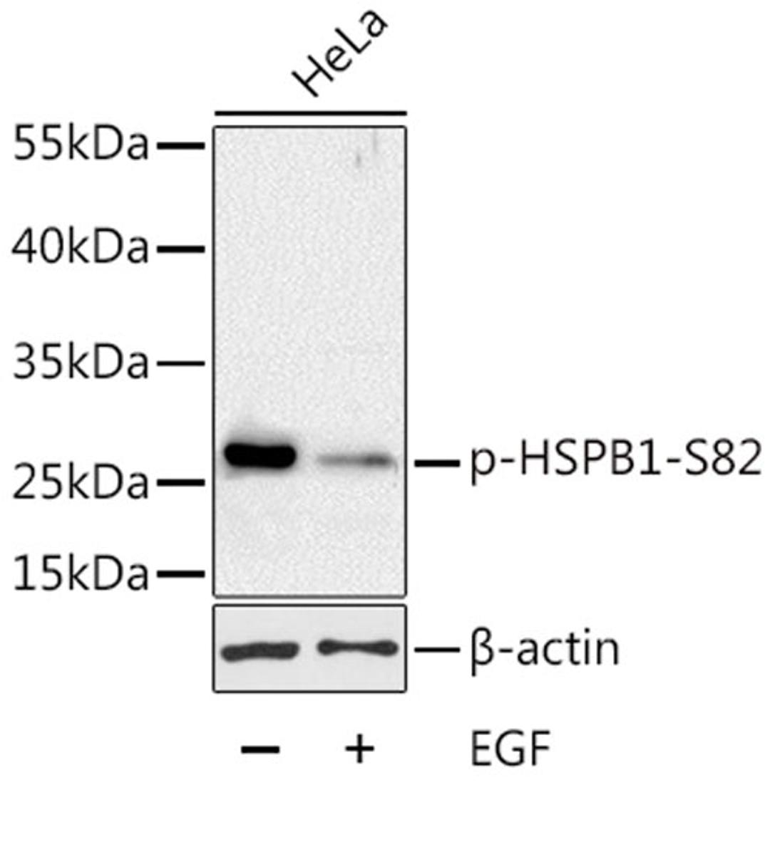 Western blot - Phospho-HSPB1-S82 antibody (AP0041)