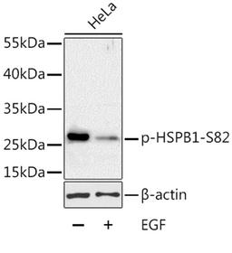 Western blot - Phospho-HSPB1-S82 antibody (AP0041)